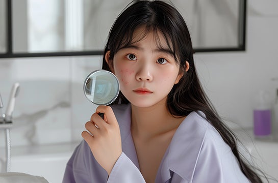 ความเชื่อผิดๆ เรื่องสิวที่ควรถูกแก้ไข